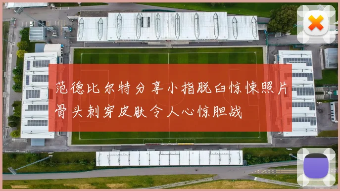 范德比尔特分享小指脱臼惊悚照片骨头刺穿皮肤令人心惊胆战